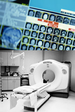 Brain Scans