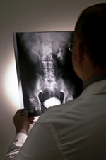 X-ray inspection
