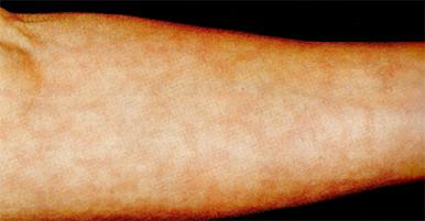 Arm